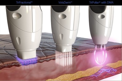 Triple action pollogen technology in the DIVINE PRO